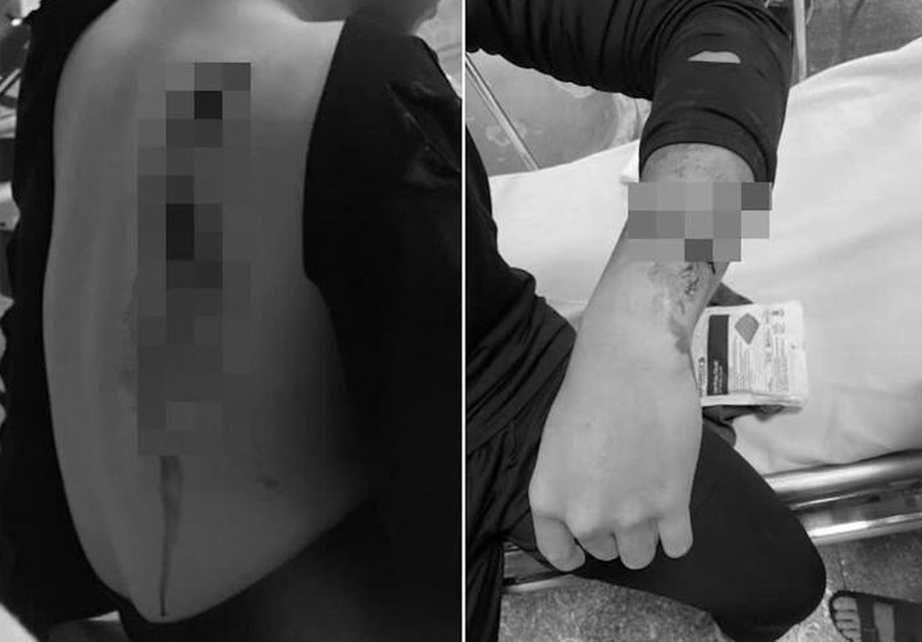 Lộ nguy&ecirc;n nh&acirc;n nam sinh lớp 10 bị ch&eacute;m trọng thương giữa đường phố H&agrave; Nội- Ảnh 1.