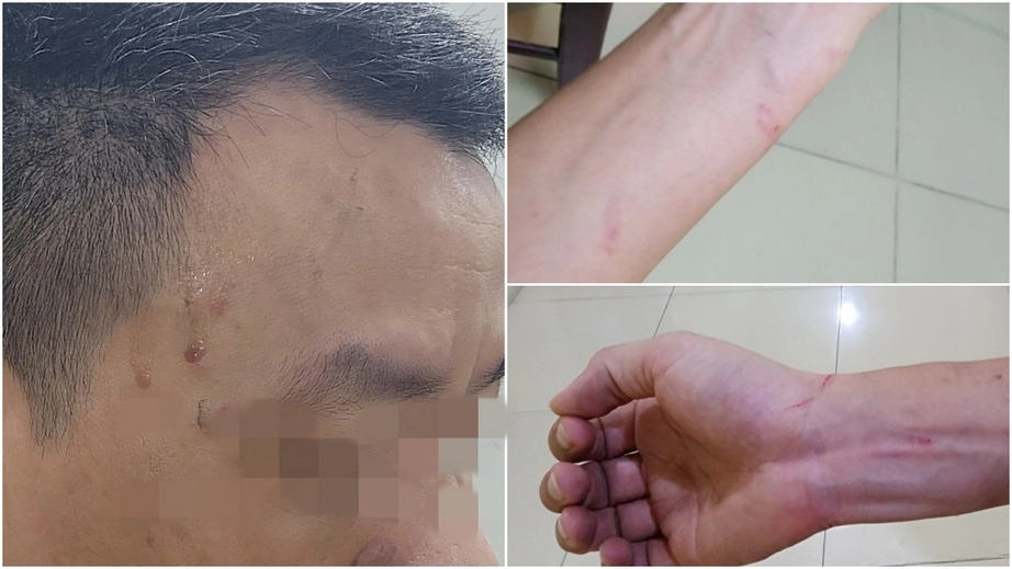 Chủ tịch H&agrave; Nội chỉ đạo l&agrave;m r&otilde; vụ 2 ph&oacute;ng vi&ecirc;n bị h&agrave;nh hung khi t&aacute;c nghiệp- Ảnh 2.