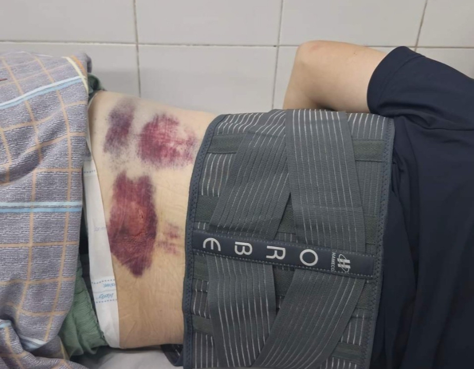 Quảng Ninh: X&aacute;c minh vụ bảo vệ doanh nghiệp bị tố đ&aacute;nh người để xe m&aacute;y tr&ecirc;n vỉa h&egrave;- Ảnh 2.