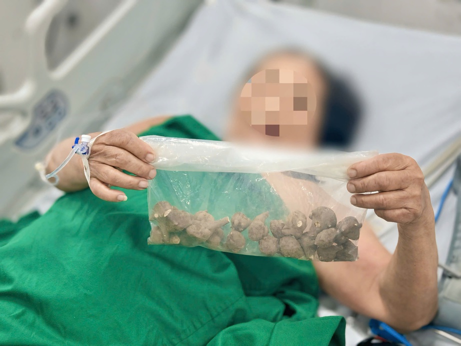 Một cụ b&agrave; nguy kịch v&igrave; d&ugrave;ng ấu tầu chữa khớp- Ảnh 2.