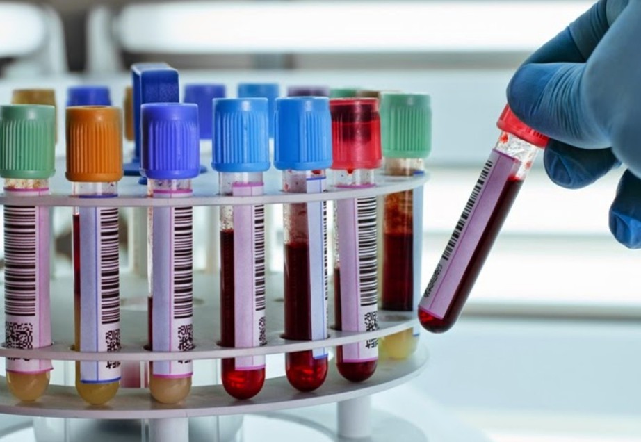 Ph&aacute;t hiện nguy&ecirc;n nh&acirc;n b&iacute; ẩn khiến một bệnh nhi bị chẩn đo&aacute;n nhầm l&agrave; vi&ecirc;m tụy cấp- Ảnh 1.