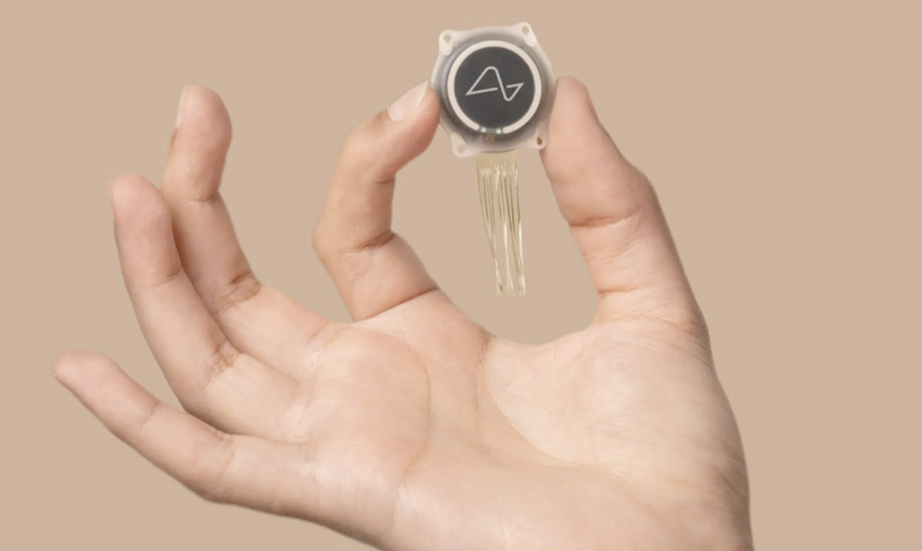 Tác dụng thần kỳ từ chip não của tỷ phú Elon Musk - Ảnh 2. Tác dụng thần kỳ từ chip não của tỷ phú Elon Musk - Ảnh 2.