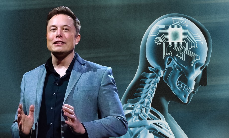 Tác dụng thần kỳ từ chip não của tỷ phú Elon Musk - Ảnh 1. Tác dụng thần kỳ từ chip não của tỷ phú Elon Musk - Ảnh 1.
