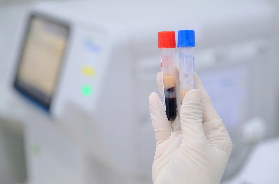 Nuông chiều bản thân, nhiều người mỡ máu tăng vọt- Ảnh 1. Nuông chiều bản thân, nhiều người mỡ máu tăng vọt- Ảnh 1.