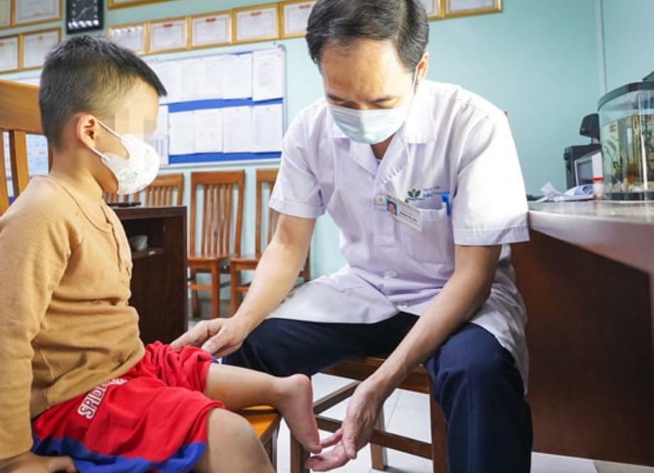 Th&agrave;nh c&ocirc;ng phẫu thuật xoay cẳng ch&acirc;n 180 độ cho b&eacute; trai 5 tuổi- Ảnh 1.