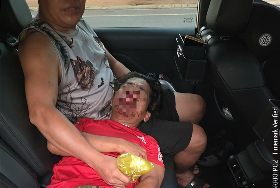 CSGT Gia Lai dùng xe chuyên dụng "mở đường" hơn 20km đưa người bị đứt lưỡi đi cấp cứu- Ảnh 1.