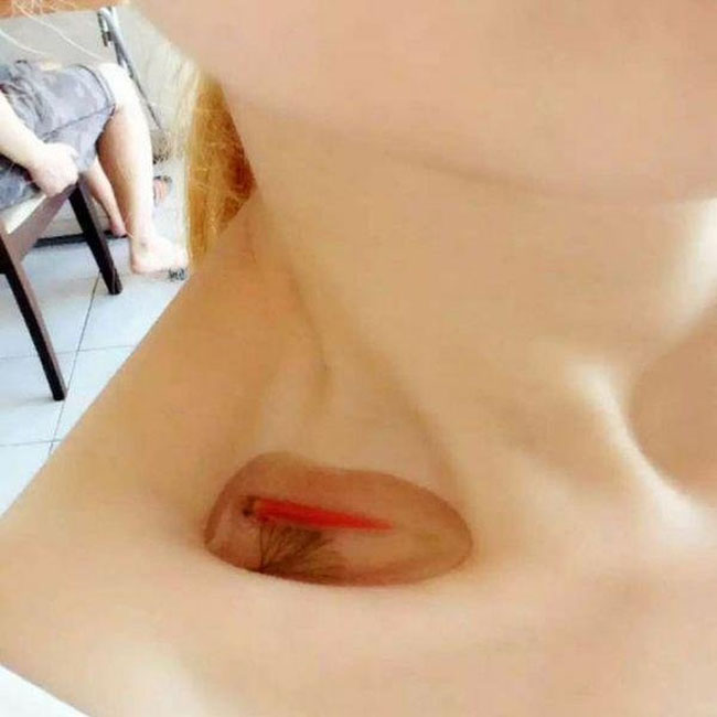 "Bể c&aacute;" trong hốc xương đ&ograve;n l&agrave; xu hướng phổ biến ở Trung Quốc để c&aacute;c c&ocirc; g&aacute;i thể hiện m&igrave;nh gầy như thế n&agrave;o.