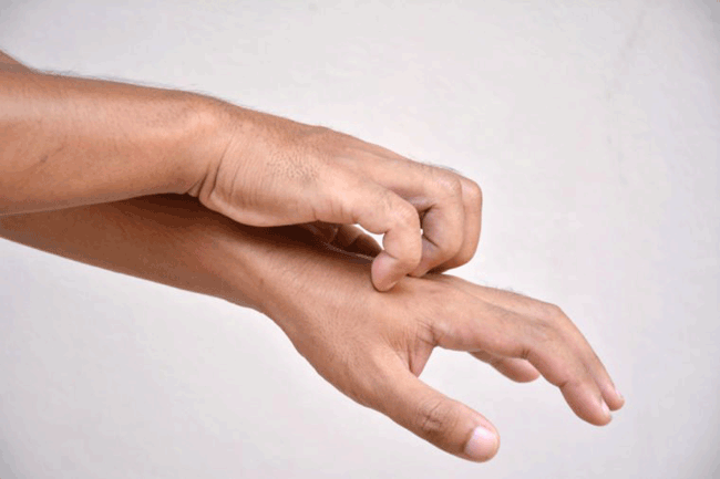 2. Ngứa mãn tính: Ngứa có thể là dấu hiệu của 1 vấn đề vô hại và dễ điều trị như da khô hoặc viêm da tiếp xúc. Nhưng nó cũng có thể là dấu hiệu của bệnh ung thư hạch, đa u tủy hoặc thậm chí là bệnh tiểu đường.