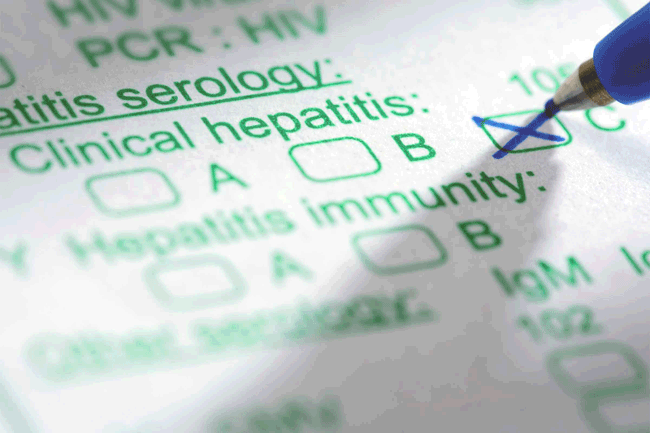 1. T&igrave;nh dục kh&ocirc;ng an to&agrave;n: Quan hệ t&igrave;nh dục kh&ocirc;ng an to&agrave;n, đặc biệt l&agrave; với nhiều &nbsp;người c&oacute; thể l&agrave; mối đe dọa lớn hơn đối với sức khỏe của bạn. Nguy cơ lớn nhất v&agrave; kh&aacute; phổ biến l&agrave; bạn c&oacute; thể mắc bệnh vi&ecirc;m gan, bệnh c&oacute; khả năng g&acirc;y tử vong l&acirc;y qua đường t&igrave;nh dục.
