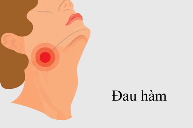 11. Đau h&agrave;m: Ung thư miệng c&oacute; thể l&agrave;m cho h&agrave;m của bạn bị tổn thương khi mở miệng. H&atilde;y đến gặp b&aacute;c sĩ nếu cơn đau kh&ocirc;ng thuy&ecirc;n giảm trong v&ograve;ng 2 tuần.
