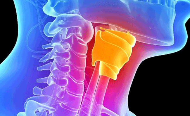 2. H&uacute;t thuốc l&aacute; l&agrave; yếu tố nguy cơ quan trọng nhất g&acirc;y ung thư thanh quản v&agrave; v&ograve;m họng. Nguy cơ mắc c&aacute;c bệnh ung thư n&agrave;y ở những người h&uacute;t thuốc cao hơn nhiều so với những người kh&ocirc;ng h&uacute;t thuốc. H&uacute;t c&agrave;ng nhiều, nguy cơ c&agrave;ng lớn.
