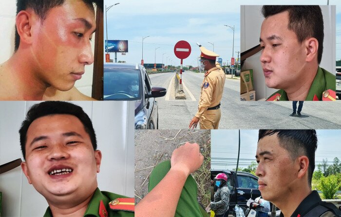 H&igrave;nh ảnh những người chiến sĩ 2 m&agrave;u da v&igrave; ch&aacute;y nắng nơi tuyến đầu khiến ai cũng cảm thấy thắt l&ograve;ng