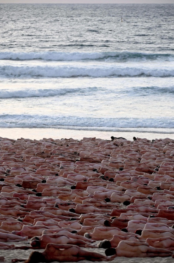 Về bệnh ung thư da, đ&acirc;y l&agrave; một trong c&aacute;c ung thư thường gặp v&agrave; kh&aacute; dễ chẩn đo&aacute;n. Ung thư da (kh&ocirc;ng kể ung thư hắc tố) l&agrave; c&aacute;c ung thư xuất ph&aacute;t từ biểu m&ocirc; da che phủ mặt ngo&agrave;i cơ thể, gồm nhiều lớp tế b&agrave;o. Lớp tế b&agrave;o đ&aacute;y sinh ra ung thư tế b&agrave;o đ&aacute;y, lớp tế b&agrave;o vảy sinh ra ung thư biểu m&ocirc; vảy. C&aacute;c &nbsp;tuyến phụ thuộc của da như tuyến mồ h&ocirc;i, tuyến b&atilde; sinh ra ung thư tuyến mồ h&ocirc;i, tuyến b&atilde;&hellip;