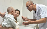 Phục hồi khuôn mặt cho bé trai 26 tháng tuổi bị chó nhà cắn nát vùng hàm mặt