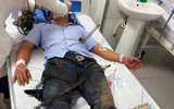 Cần Thơ: Báo động đỏ nội viện cứu thanh niên bị 2 thanh sắt đâm xuyên người