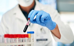 Xét nghiệm dấu ấn ung thư khiến nhiều người mất ăn, mất ngủ