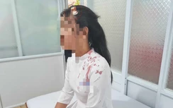 Nữ sinh lớp 10 bị bạn đánh phải khâu bốn mũi trên đầu