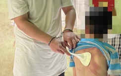Bắt giữ người đàn ông hành hạ con đẻ