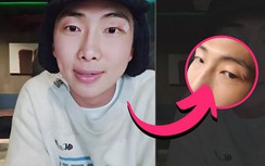 Bị máy quay đập vào mặt, RM (BTS) khâu 5 mũi ở mắt