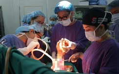 Cô gái gần đứt lìa cánh tay do áo chống nắng quấn vào bánh xe máy