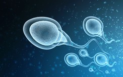 Bất ngờ khi so sánh tinh trùng của 2 nhóm dùng điện thoại ít và nhiều