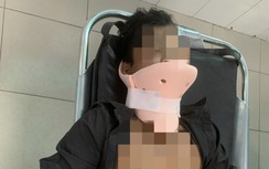 Vụ tai nạn 3 người tử vong ở Đồng Nai: Nạn nhân còn lại say xỉn, bị gãy cột sống cổ