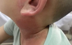 Nhiều người khốn khổ vì kiến ba khoang