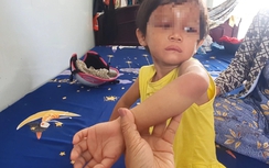 Lời khai của người cha nuôi nhiều lần đánh bé gái 4 tuổi ở Cà Mau