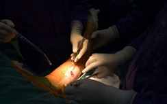 Vụ cháy chung cư mini ở Khương Hạ: Tin mới về sức khoẻ bệnh nhân cấp cứu tại các bệnh viện