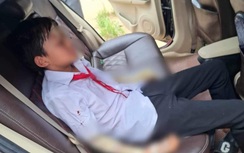 Nổ bóng bay, 10 học sinh bị bỏng: Thầy giáo hút thuốc bị xử lý thế nào?