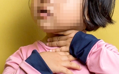 Viêm tuyến giáp tự miễn ở trẻ có chữa được không?