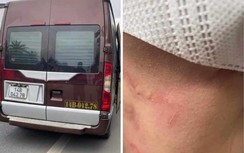 Công an vào cuộc vụ khách tố bị hành hung khi đòi xuống xe