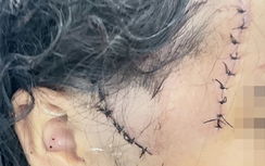 Đi nhậu về, gã đàn ông chém vợ hờ cùng con riêng trọng thương