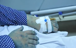 Nhiều bệnh nhân thủy đậu và ho gà nhập viện vì biến chứng