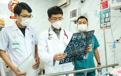 Lý do ngày càng nhiều người trẻ đột quỵ