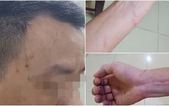 Chủ tịch Hà Nội chỉ đạo làm rõ vụ 2 phóng viên bị hành hung khi tác nghiệp
