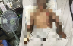 Vụ cháy lớn ở công ty giày dép tại Đồng Nai: Một nam nhân viên bị bỏng nặng