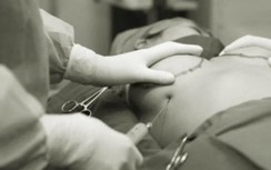 Nâng ngực bằng mỡ tự thân, một phụ nữ mưng mủ hai bên ngực, nhiễm trùng da