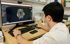 Nam sinh rối loạn tâm thần, tổn thương não vì thuốc lá điện tử