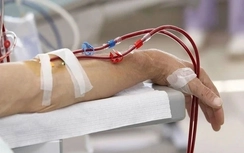 "Lọc máu siêu công nghệ" có ngăn ngừa được đột quỵ?