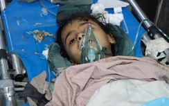 Mỹ không kích Yemen, số người thương vong tăng vọt