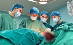 Hồi sinh cho cô gái sau 16 lần xạ trị ung thư vú