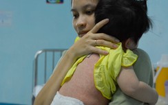 Sởi lây nhanh hơn Covid-19, Bộ Y tế khuyến cáo 5 biện pháp phòng bệnh