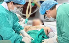 Bội nhiễm do bệnh thủy đậu "đốn ngã" thanh niên khỏe mạnh