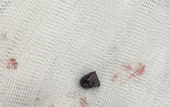 Bắt giữ kẻ dùng súng tự chế bắn trọng thương lái xe tải