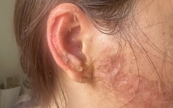 Khởi tố vụ án người phụ nữ bị bắt giữ đánh đập, cắt tóc ở Cà Mau