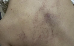 Tạm đình chỉ công tác 2 giáo viên nghi bạo hành trẻ ở trường Mầm non Gia Thụy