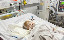 Công an vào cuộc vụ bé trai xuất huyết não bất thường ở nhóm trông trẻ tự phát