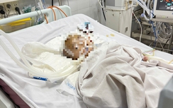 Quảng Ngãi rà soát toàn bộ nhóm trẻ, lớp mầm non sau vụ bé trai xuất huyết não bất thường