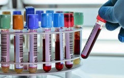 Phát hiện nguyên nhân bí ẩn khiến một bệnh nhi bị chẩn đoán nhầm là viêm tụy cấp